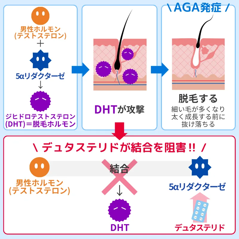 AGAの仕組み-デュタステリドの作用メカニズム